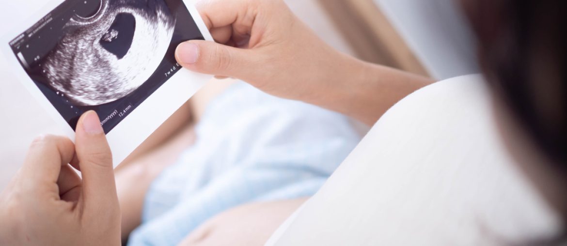A pregnant woman is looking at an ultrasound photo of fetus.